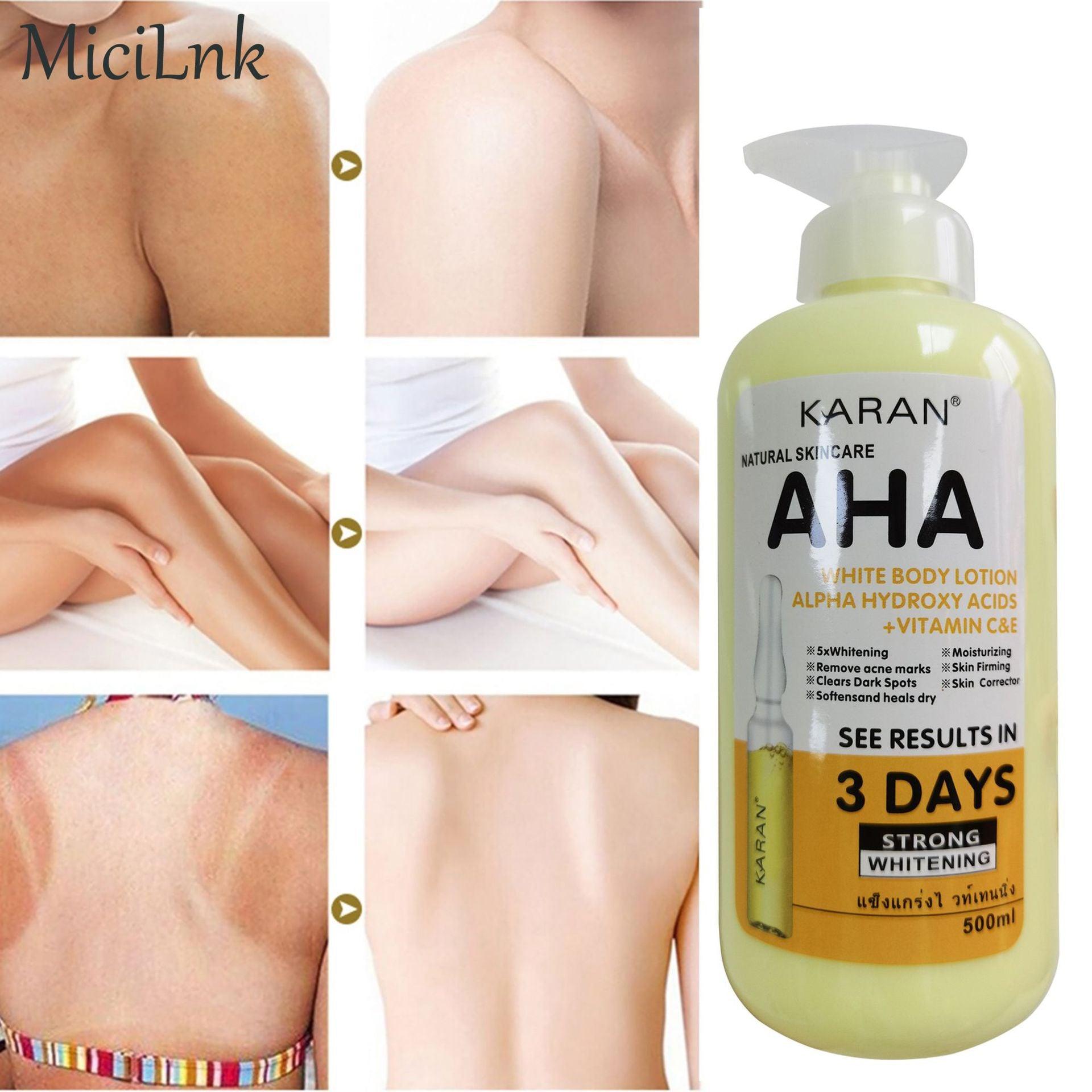 Experience the Miracle in Just 3 Days - KARAN Intense Whitening Body Lotion. - WeArtSpecial